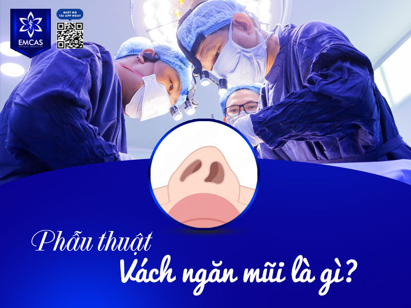 Phẫu thuật vách ngăn mũi là một thủ thuật ngoại khoa nhằm chỉnh sửa tình trạng vách mũi  bị cong vẹo, lệch sang một bên