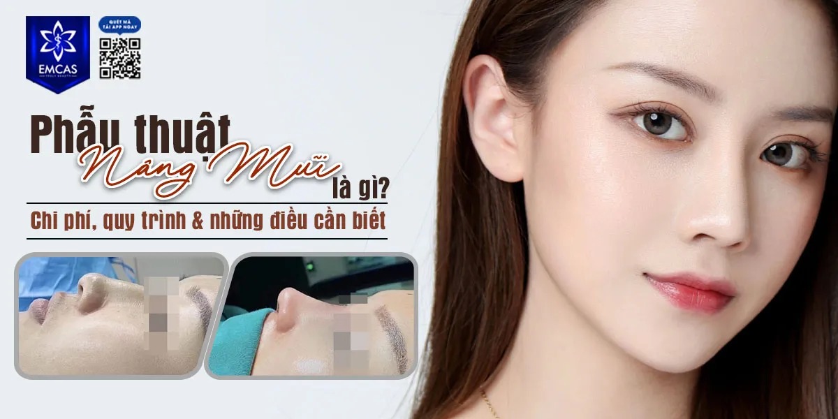 PHẪU THUẬT NÂNG MŨI LÀ GÌ? CHI PHÍ, QUY TRÌNH & NHỮNG ĐIỀU CẦN BIẾT