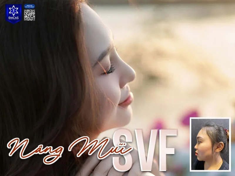 Tư vấn và thăm khám nâng mũi tại EMCAS