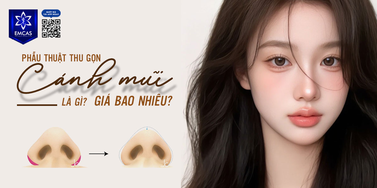 PHẪU THUẬT THU GỌN CÁNH MŨI LÀ GÌ? GIÁ BAO NHIÊU?