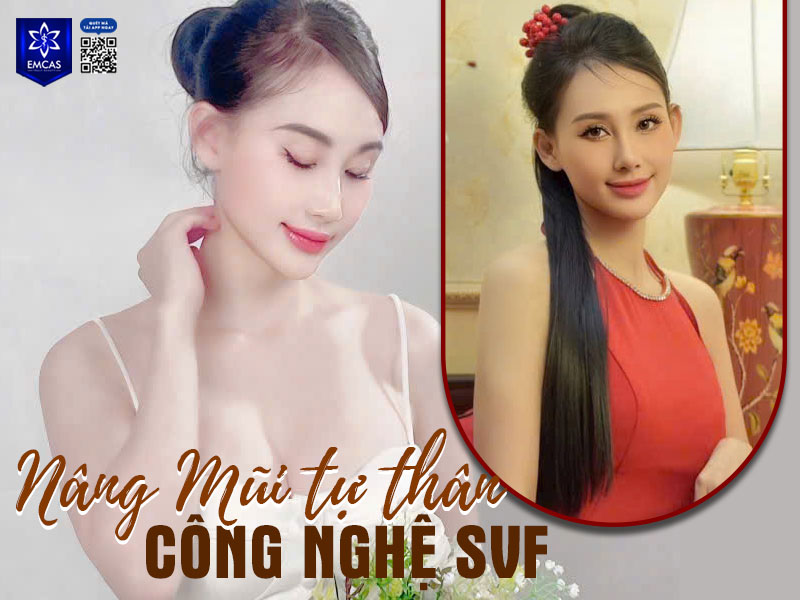 Quy trình nâng mũi chuẩn y khoa của Bệnh Viện Thẩm Mỹ EMCAS gồm 4 bước