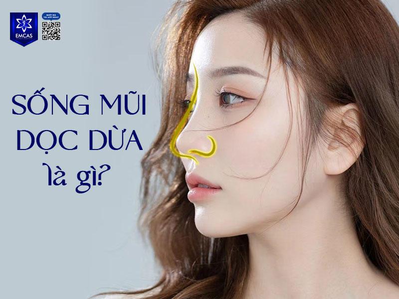 Sống mũi dọc dừa là thuật ngữ dân gian dùng để chỉ dáng mũi cao, thẳng và mềm mại như thân cây dừa non