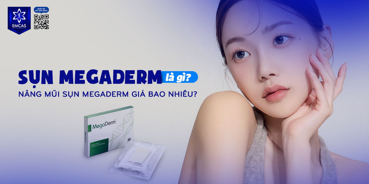 SỤN MEGADERM LÀ GÌ?