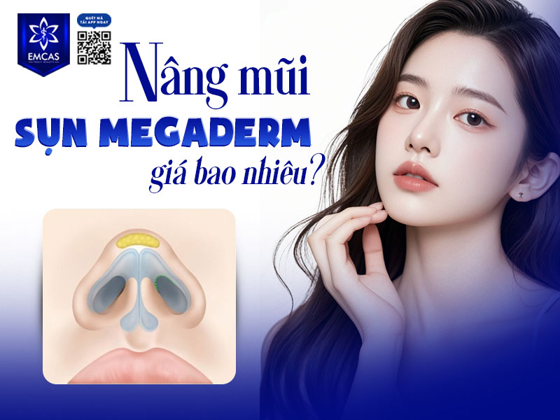 Chi phí nâng mũi bọc Megaderm thường cao hơn so với sụn silicon do đây là vật liệu sinh học cao cấp, có độ tương thích tốt và hạn chế biến chứng.