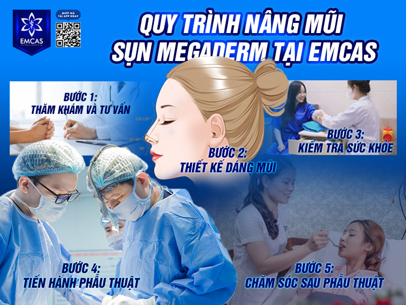 Tại Bệnh Viện Thẩm Mỹ EMCAS, quy trình nâng mũi bọc Megaderm được xây dựng khoa học, đảm bảo an toàn và chuẩn y khoa.