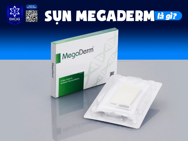 Sụn Megaderm là một loại vật liệu nâng mũi được sản xuất từ biểu bì người, đã qua xử lý bằng công nghệ y khoa hiện đại để loại bỏ toàn bộ tế bào và chỉ giữ lại cấu trúc nền collagen.