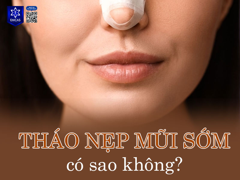 Khi tháo nẹp sớm hơn thời gian khuyến nghị của bác sĩ, mũi có nguy cơ bị di lệch, mất form hoặc gây biến dạng vùng sụn mới đặt.