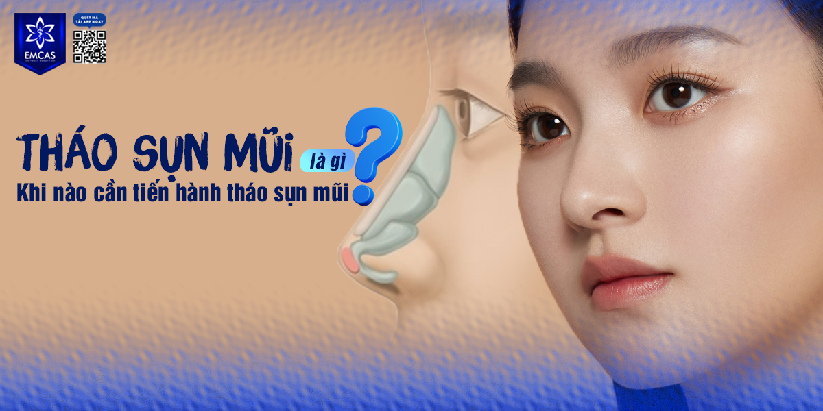 THÁO SỤN MŨI LÀ GÌ?