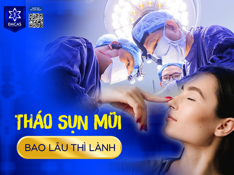 Sau phẫu thuật tháo sụn mũi, mũi thường giảm sưng sau 7–10 ngày. Quá trình lành thương và ổn định dáng mũi kéo dài khoảng 1–3 tháng, tùy thuộc cơ địa và chế độ chăm sóc.