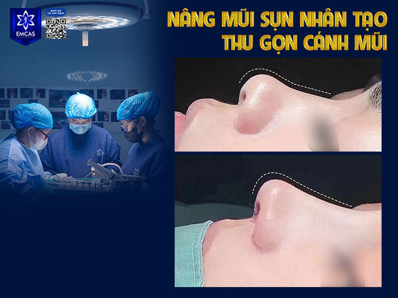 Tại TP.HCM, Bệnh Viện Thẩm Mỹ EMCAS là một trong những đơn vị được nhiều khách hàng tin chọn.