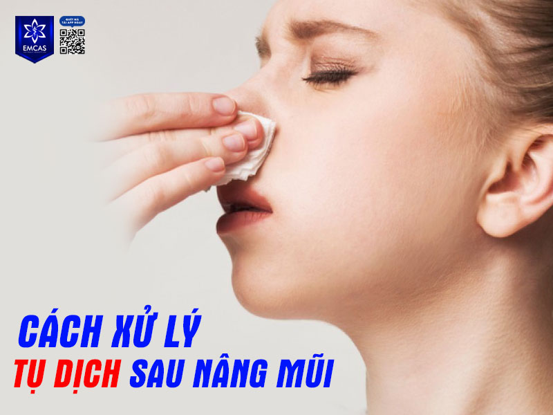 Nếu không được xử lý đúng cách, tụ dịch có thể dẫn đến nhiễm trùng, đau nhức hoặc ảnh hưởng dáng mũi sau khi lành