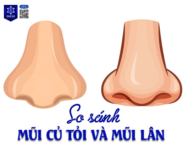 Cả mũi củ tỏi và mũi lân đều thuộc nhóm dáng mũi có đầu mũi to, dày và nhiều mô mềm