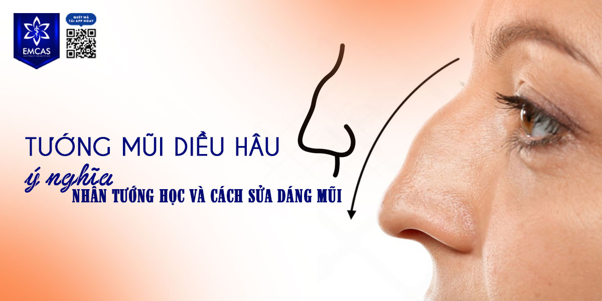 TƯỚNG MŨI DIỀU HÂU