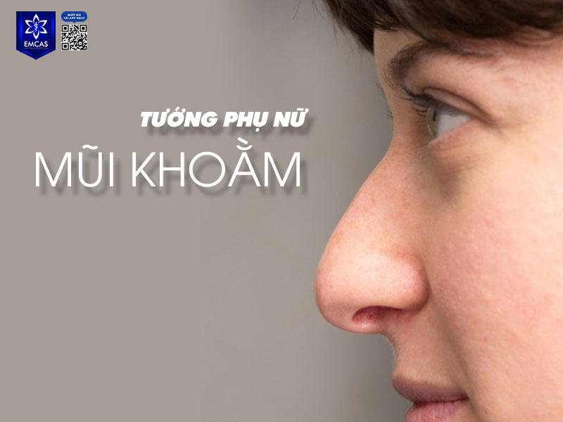 Phụ nữ mũi khoằm thường mang nét cá tính mạnh, độc lập và quyết đoán.  Hình 5: text: nâng mũi cấu trúc - chỉnh sửa mũi khoằm