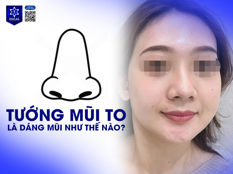 Tướng mũi to là dáng mũi có phần sống mũi rộng, đầu mũi đầy đặn và lỗ mũi to, rõ rệt khi nhìn từ chính diện