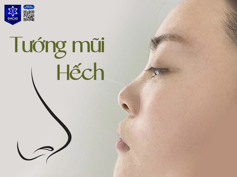 Theo nhân tướng học, phụ nữ có mũi hếch thường gặp khó khăn trong việc kết bạn, gắn kết bạn bè, khó hoàn nhập, đường tình duyên cũng dễ lận đận