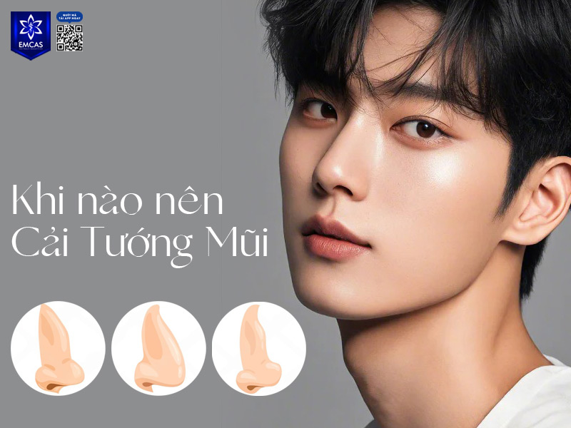 Trước khi quyết định thay đổi dáng mũi, nam giới nên tham khảo kỹ ý kiến của bác sĩ chuyên khoa