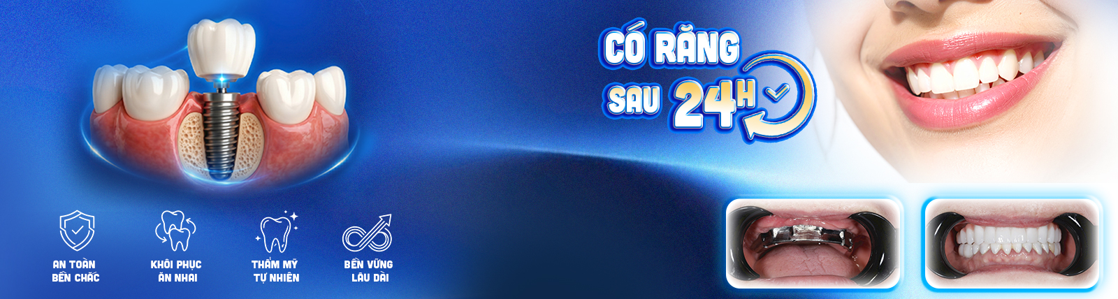 Banner Service