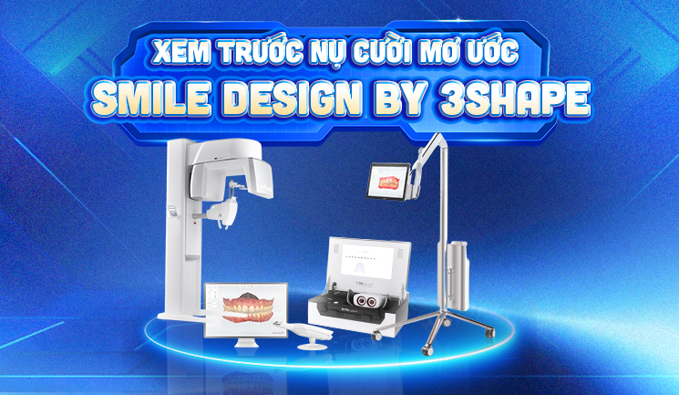 mắt