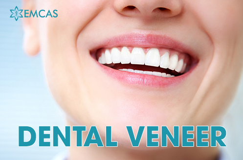 DENTAL VENEER