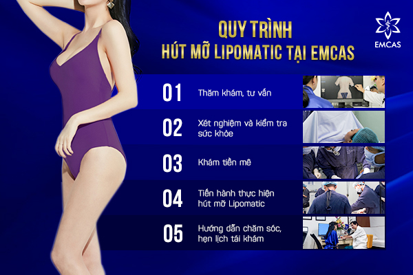 cong nghe hut mo lipomatic, công nghệ hút mỡ lipomatic
