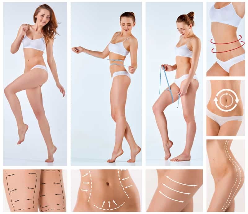 hút mỡ bụng Emcas