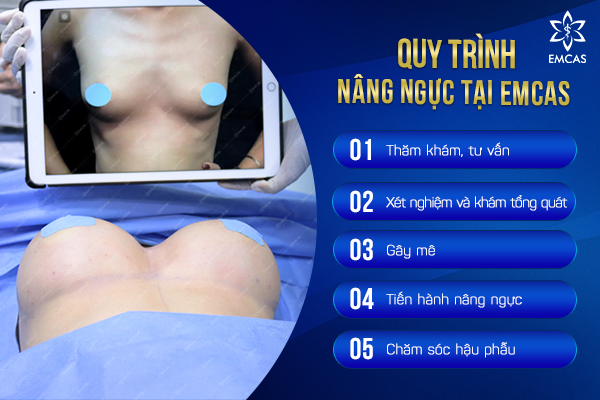Thẩm Mỹ Vòng 1 - Căng Tròn Quyến Rũ - Mê Đắm Ánh Nhìn