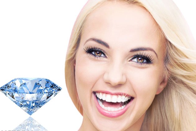 bọc răng sứ thẩm mỹ Emcas
