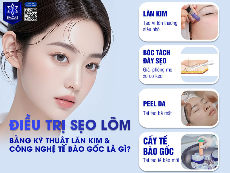 Điều trị sẹo lõm bằng kỹ thuật lăn kim và công nghệ tế bào gốc là phương pháp thẩm mỹ kết hợp nhiều tác động nhằm cải thiện cấu trúc da từ cả bề mặt lẫn tầng sâu bên dưới.