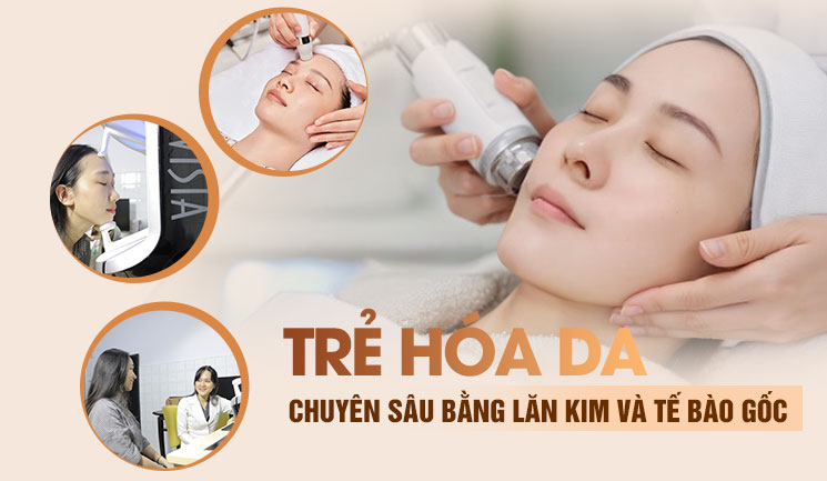 mắt
