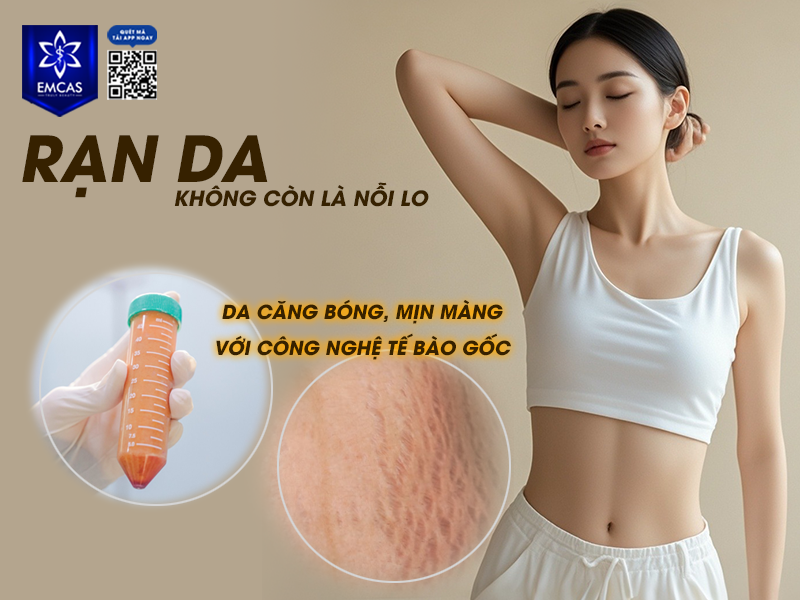 Rạn Da Có Ảnh Hưởng Gì Không?