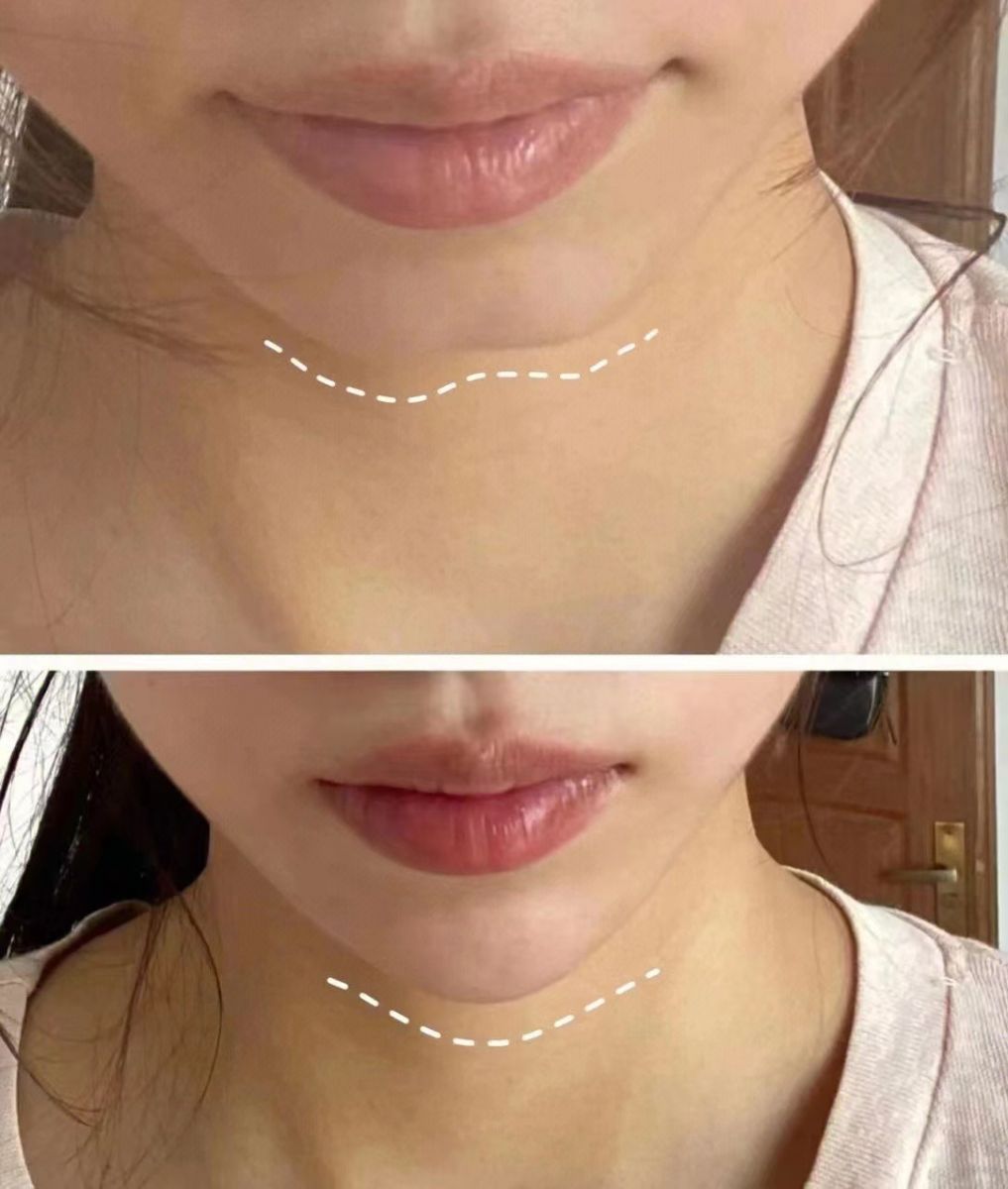 Một Số Dịch Vụ Thẩm Mỹ Khuôn Mặt Hiện Nay