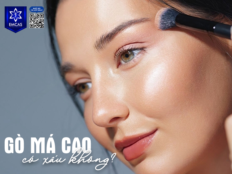 Gò Má Cao Có Xấu Không? Khi Nào Cần Hạ Gò Má?