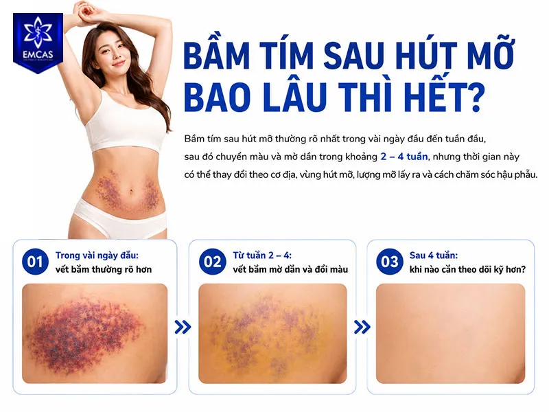Bầm tím sau hút mỡ thường rõ nhất trong vài ngày đầu đến tuần đầu, sau đó chuyển màu và mờ dần trong khoảng  2 – 4 tuần