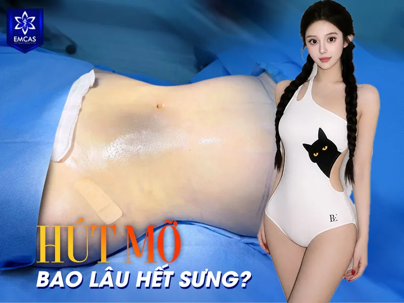 Sau hút mỡ, vùng điều trị thường giảm sưng rõ sau khoảng 2 – 4 tuần