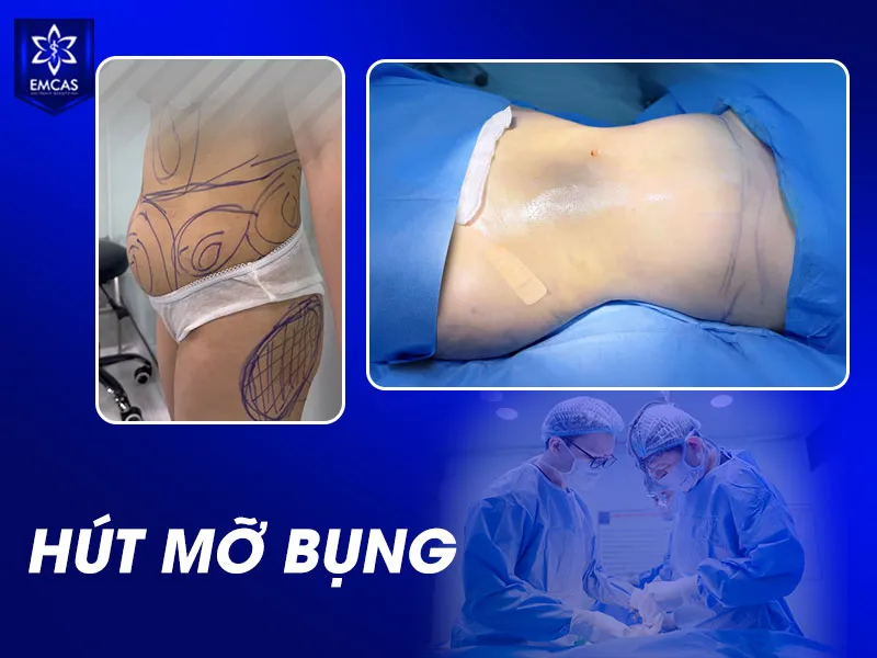 Bạn cần biết rằng không phải mọi trường hợp sưng đều là phản ứng hồi phục bình thường.