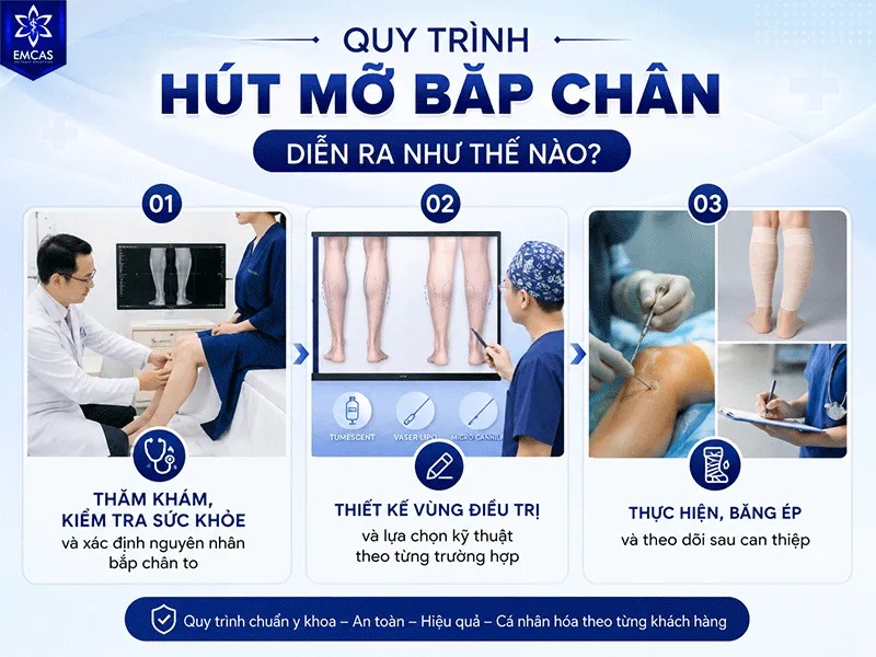 Quy trình hút mỡ bắp chân cần được cá nhân hóa dựa trên đặc điểm giải phẫu