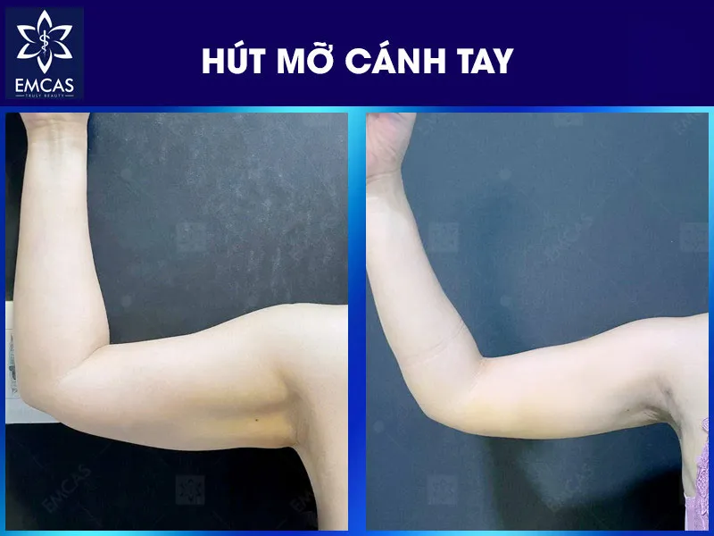 Bạn nên hỏi bác sĩ nếu có tiền sử dị ứng, bệnh nền, đang dùng thuốc, thực phẩm bổ sung
