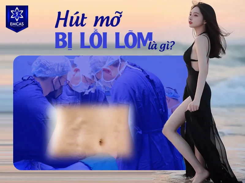 Hút mỡ bị lồi lõm là tình trạng bề mặt vùng đã hút mỡ xuất hiện các vị trí gồ, lõm hoặc gợn sóng