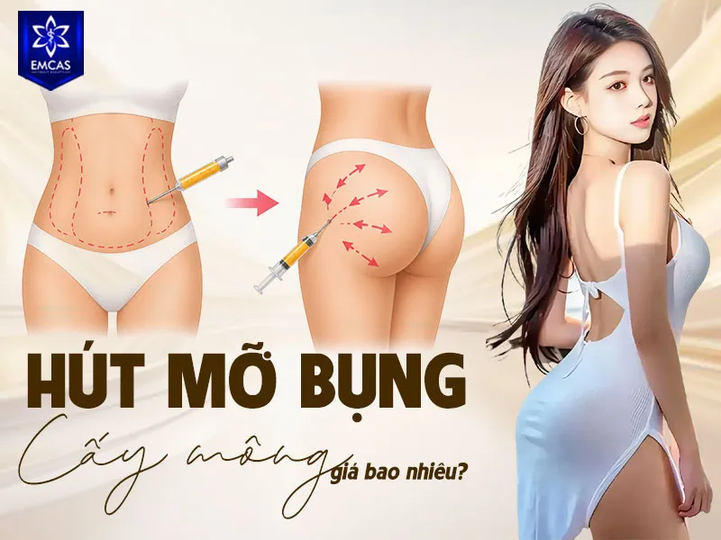 Hút mỡ bụng cấy mông có mức giá dao động từ 40 triệu đến 125 triệu đồng