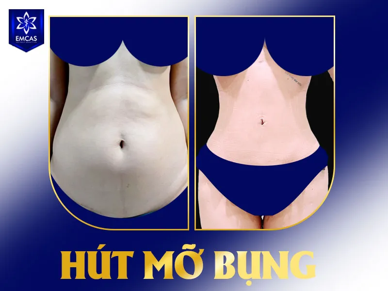 Bạn nên liên hệ bác sĩ trước khi quan hệ trở lại nếu vùng bụng vẫn đau tăng, sưng đỏ, chảy dịch