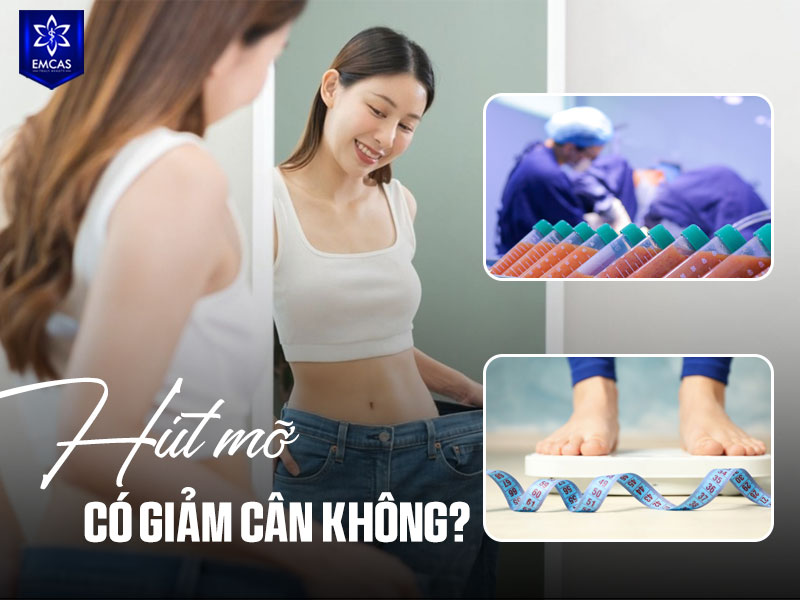 Hút mỡ không phải là phương pháp giảm cân toàn thân, mà là thủ thuật thẩm mỹ giúp loại bỏ mỡ thừa cục bộ để cải thiện đường nét cơ thể.