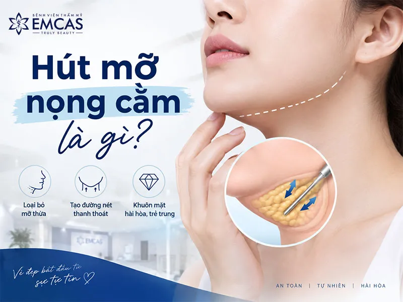 Hút mỡ nọng cằm là phương pháp loại bỏ một phần mỡ tích tụ dưới cằm