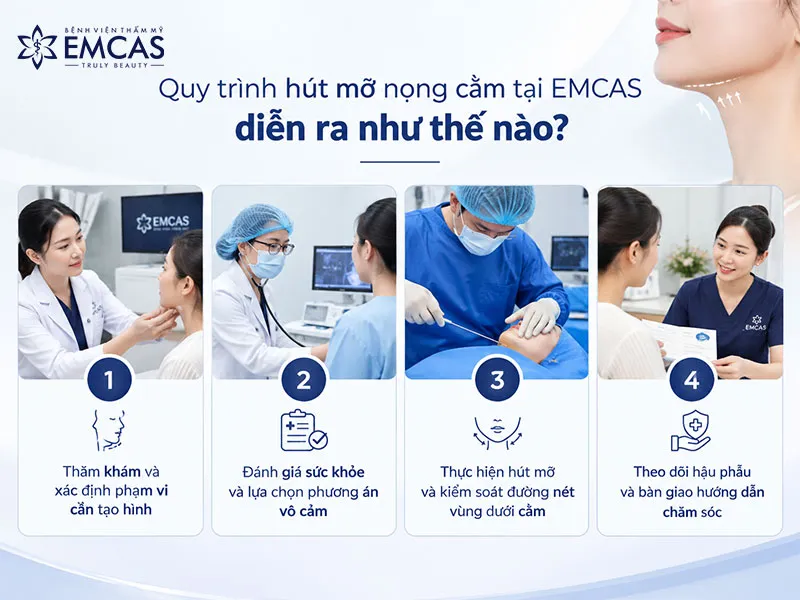 Quy trình hút mỡ nọng cằm bắt đầu bằng thăm khám vùng cằm – cổ và đánh giá sức khỏe.