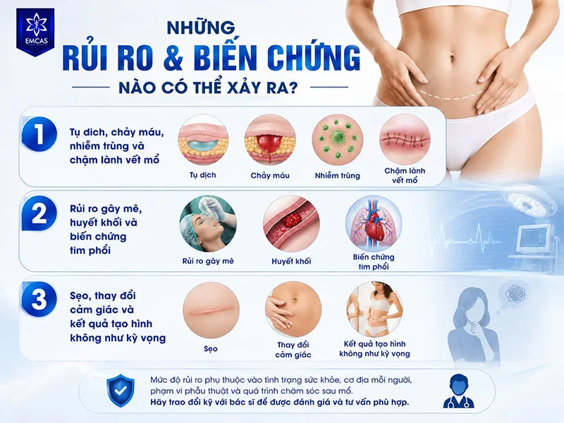Rủi ro của hút mỡ tạo hình thành bụng được chia thành ba nhóm chính