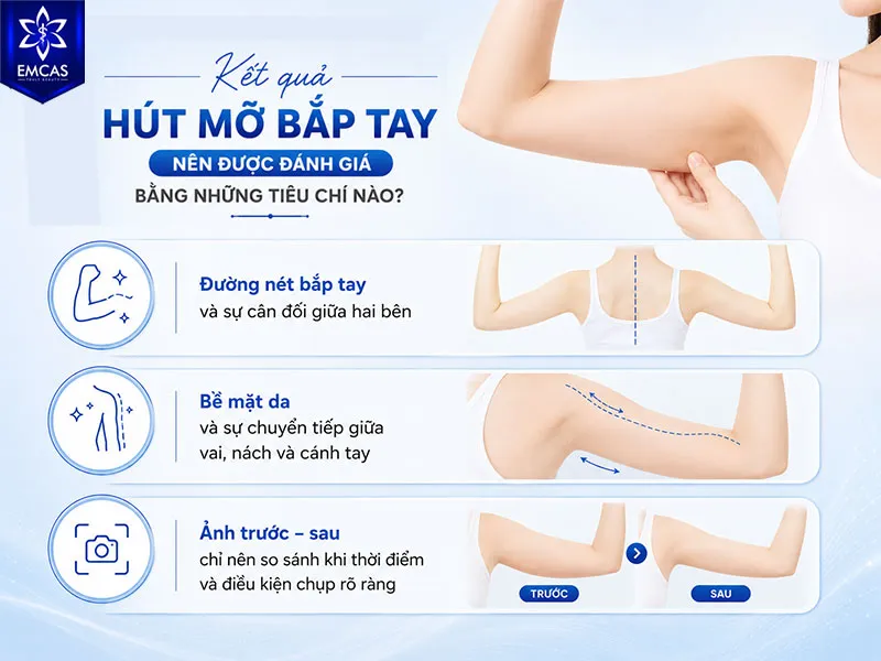 Review hút mỡ bắp tay nên được đánh giá bằng sự thay đổi đường nét, độ cân đối