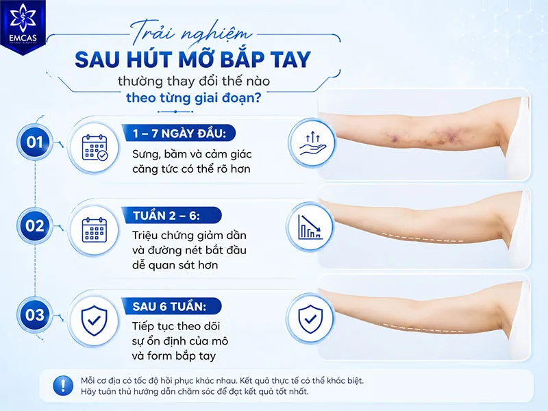 Trải nghiệm sau hút mỡ bắp tay thường thay đổi theo thời gian
