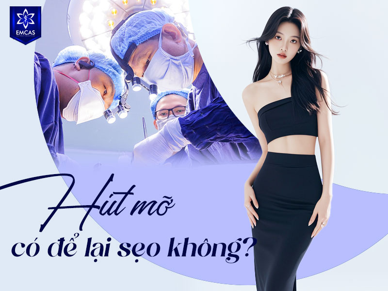 Hút mỡ có thể để lại sẹo vì bác sĩ cần tạo các vết rạch nhỏ trên da để đưa ống hút mỡ vào vùng điều trị.