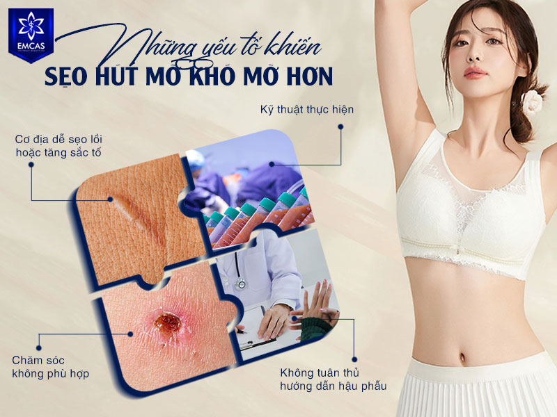 Sẹo hút mỡ có thể khó mờ hơn khi khách hàng có cơ địa dễ sẹo lồi