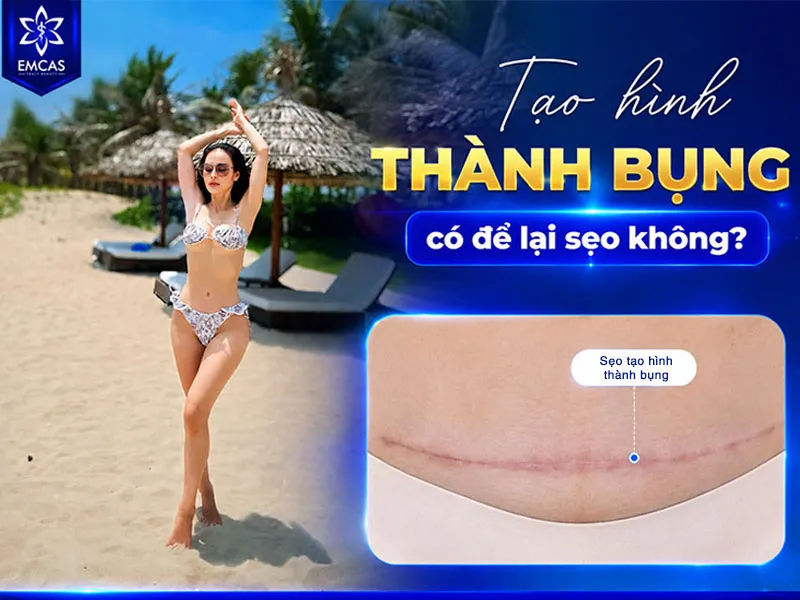 Tạo hình thành bụng có để lại sẹo vì khi thực hiện cần tạo đường rạch
